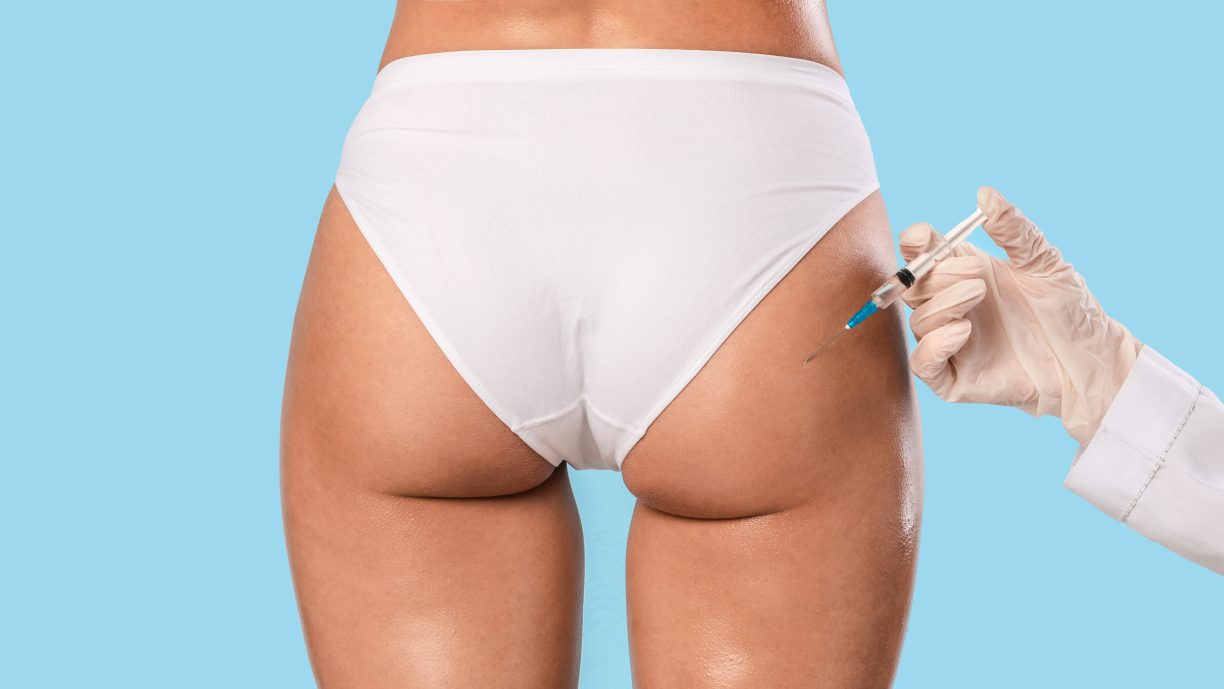 Brazilian Butt Lift: Tips for the Ideal Candidate - Vimarsana News